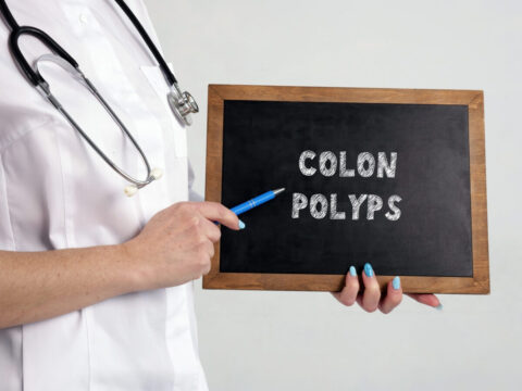 doctor explaining colon polyps